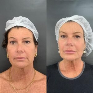 WhatsApp Image 2025-05-22 at 16.16.05 (1)